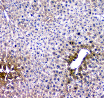 Anti-RMI2 Antibody
