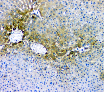 Anti-RMI2 Antibody