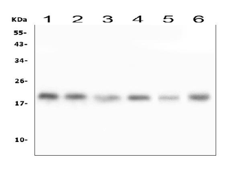 Anti-RMI2 Antibody