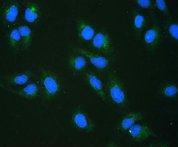 Anti-RRBP1 Antibody