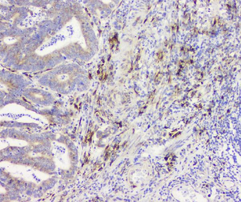 Anti-RRBP1 Antibody