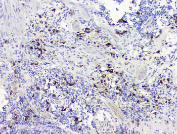 Anti-RRBP1 Antibody