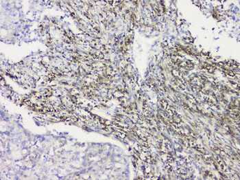 Anti-RRBP1 Antibody