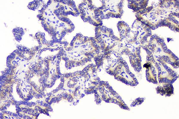 Anti-RRBP1 Antibody