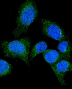 Anti-SFRP1 Antibody