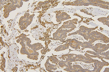 Anti-SFRP1 Antibody