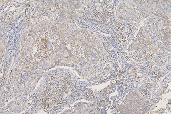 Anti-SFRP1 Antibody