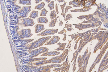 Anti-SFRP1 Antibody
