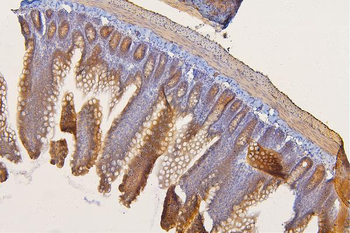 Anti-SFRP1 Antibody