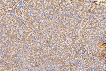 Anti-SFRP1 Antibody