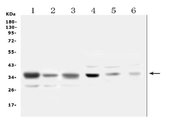 Anti-SFRP1 Antibody
