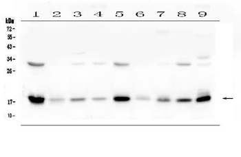 Anti-TIMM17A Antibody
