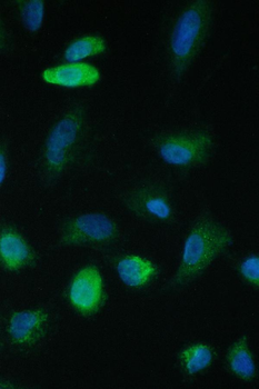 Anti-TIMM17A Antibody