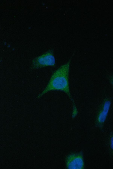 Anti-TIMM17A Antibody
