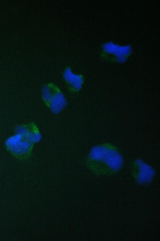 Anti-TIMM17A Antibody