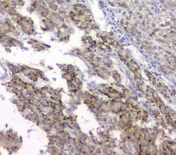 Anti-TIMM17A Antibody
