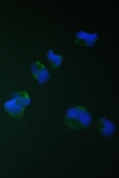 TIMM17A Antibody