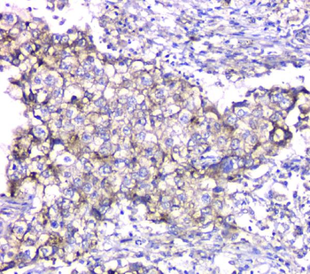 Anti-TIMM17A Antibody