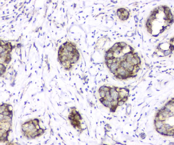 Anti-TIMM17A Antibody