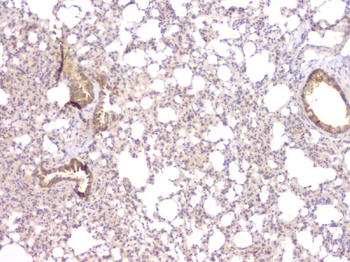 Anti-TIMM17A Antibody