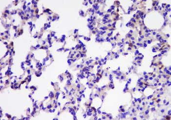 Anti-TIMM17A Antibody