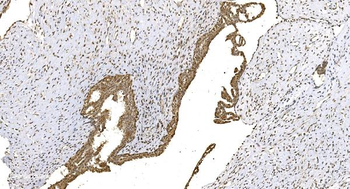 Anti-WEE1 Antibody