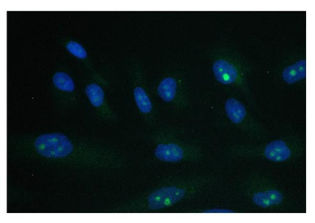 Anti-PARN Antibody (monoclonal, 11D8)