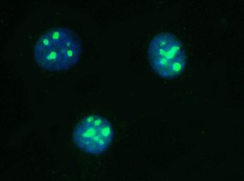 PARN Antibody (monoclonal, 11D8)