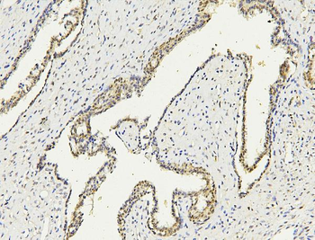 Anti-PARN Antibody (monoclonal, 11D8)