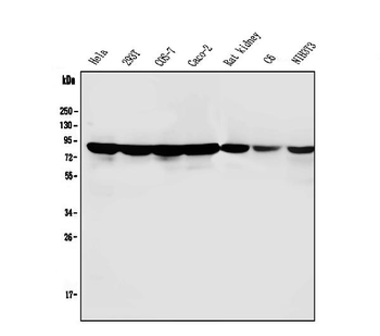 Anti-PARN Antibody (monoclonal, 11D8)
