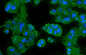 Anti-CA2 Antibody (monoclonal, 10E11)