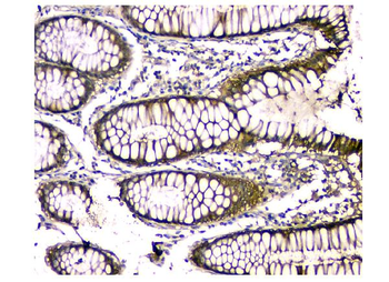 Anti-CA2 Antibody (monoclonal, 10E11)