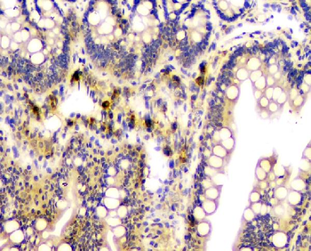 Anti-CA2 Antibody (monoclonal, 10E11)
