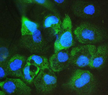 Anti-ARA9/AIP Antibody (monoclonal, 10G8)