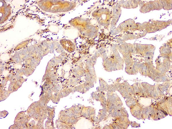 Anti-ARA9/AIP Antibody (monoclonal, 10G8)