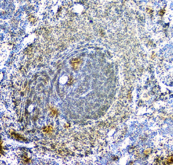 Anti-ARA9/AIP Antibody (monoclonal, 10G8)