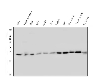Anti-Rab5/RAB5A Antibody (monoclonal, 3E9)