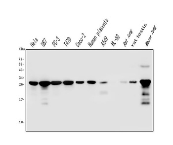 Galectin 3/LGALS3 Antibody (monoclonal, 12B12)