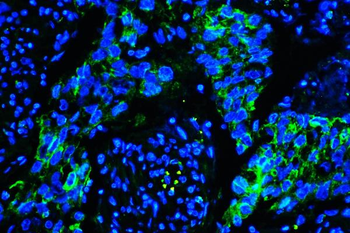 Anti-Caveolin-1/CAV1 Antibody (monoclonal, 12C7)