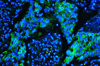 Anti-Caveolin-1/CAV1 Antibody (monoclonal, 12C7)