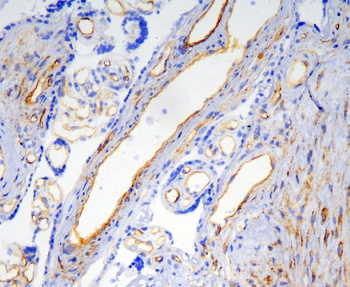 Anti-Caveolin-1/CAV1 Antibody (monoclonal, 12C7)