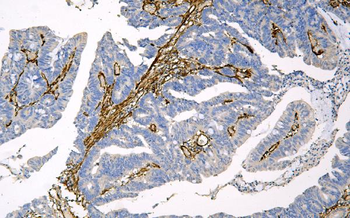 Anti-Caveolin-1/CAV1 Antibody (monoclonal, 12C7)