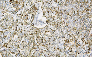 Anti-Caveolin-1/CAV1 Antibody (monoclonal, 12C7)
