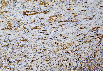 Anti-Caveolin-1/CAV1 Antibody (monoclonal, 12C7)