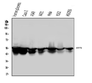 Cytokeratin 8 KRT8 Antibody (monoclonal, 3G9)