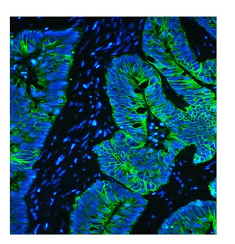 Anti-Cytokeratin 8 KRT8 Antibody (monoclonal, 3G9)