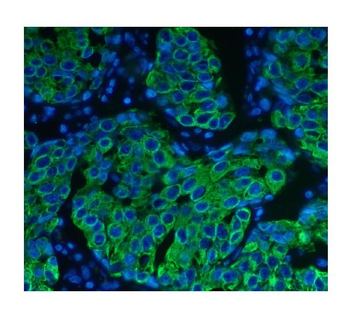 Anti-Cytokeratin 8 KRT8 Antibody (monoclonal, 3G9)