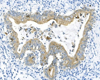 Cytokeratin 8 KRT8 Antibody (monoclonal, 3G9)