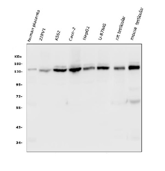 HAUSP/USP7 Antibody (monoclonal, 5E2)