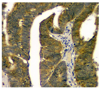 Anti-STUB1 Antibody (monoclonal, 13I8)